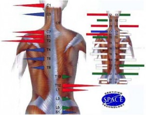 back pain chiropractor saint paul mn
